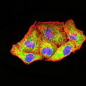 Monoclonal Mouse anti-Human PCK2 / PEPCK Antibody (clone 3D3D9, IHC, WB)