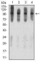 Monoclonal Mouse anti-Human ATXN1 / SCA1 Antibody (clone 4C7B11, IHC, WB)