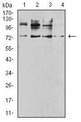 TNFRSF1B / TNFR2 Antibody (clone 2H11C2)