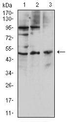 IL7R / CD127 Antibody (clone 3F5D9)
