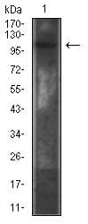 Monoclonal Mouse anti-Human IL6ST / CD130 / gp130 Antibody (clone 8D4D2, IHC, WB)