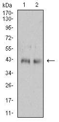 Monoclonal Mouse anti-Human IL2RG / CD132 Antibody (clone 4A8E5, WB)