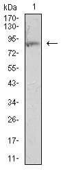 ITGB2 / CD18 Antibody (clone 3C11G5)