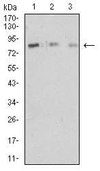 Monoclonal Mouse anti-Human ITGB2 / CD18 Antibody (clone 3D1B3, WB)