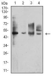 Monoclonal Mouse anti-Human IL13RA1 / IL13R Alpha 1 Antibody (clone 8A3E3, WB)
