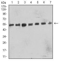 B3GAT1 Antibody (clone 3F6D6)