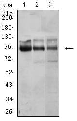 Monoclonal Mouse anti-Human CTNNB1 / Beta Catenin Antibody (clone 7C5D2, IHC, WB)