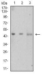 Monoclonal Mouse anti-Human LTBR Antibody (clone 1D1C5C8, WB)