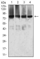 Monoclonal Mouse anti-Human MTA1 Antibody (clone 6B1E9, WB)