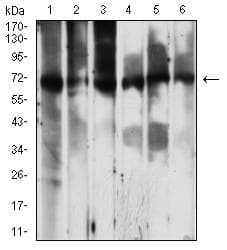 Monoclonal Mouse anti-Human PCK2 / PEPCK Antibody (clone 3D3D9, IHC, WB)