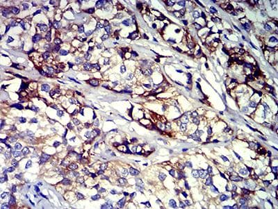 Monoclonal Mouse anti-Human ITGB3 / Integrin Beta 3 / CD61 Antibody (clone 3E8A6, IHC, WB)