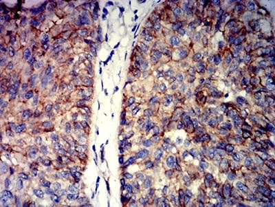 Monoclonal Mouse anti-Human CTNNB1 / Beta Catenin Antibody (clone 7C5D2, IHC, WB)