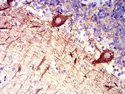 Monoclonal Mouse anti-Human RAB27B Antibody (clone 2G11C2, IHC, WB)