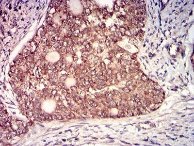 Monoclonal Mouse anti-Human IL6ST / CD130 / gp130 Antibody (clone 8D4D2, IHC, WB)