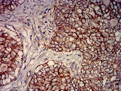 Monoclonal Mouse anti-Human CD46 Antibody (clone 1A5A5, IHC, WB)