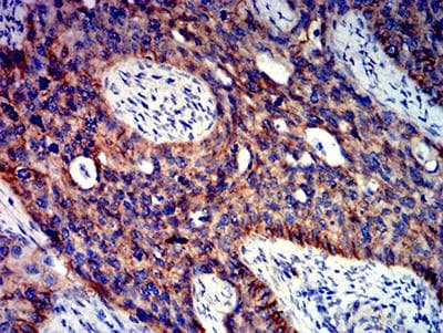 Monoclonal Mouse anti-Human CTNNB1 / Beta Catenin Antibody (clone 7C5D2, IHC, WB)