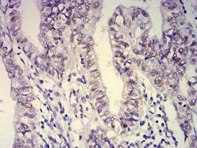 Monoclonal Mouse anti-Human ATXN1 / SCA1 Antibody (clone 4C7B11, IHC, WB)