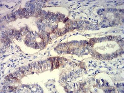 BCAM / CD239 Antibody (aa32-197, clone 5C5A6)