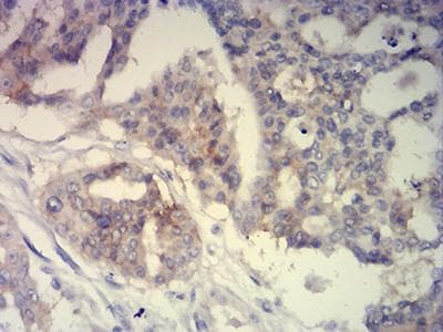 BCAM / CD239 Antibody (aa32-197, clone 5C5A6)