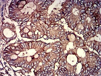 Monoclonal Mouse anti-Human CD46 Antibody (clone 1A5A5, IHC, WB)