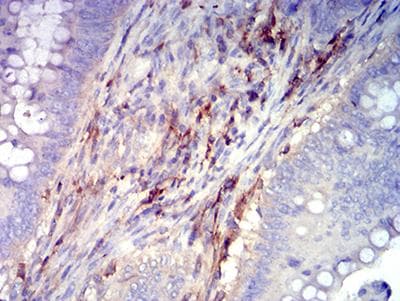 Monoclonal Mouse anti-Human ITGB3 / Integrin Beta 3 / CD61 Antibody (clone 3E8A6, IHC, WB)