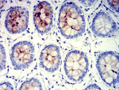 Monoclonal Mouse anti-Human MUC5B Antibody (clone 7F5A1, IHC, WB)
