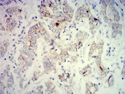 Monoclonal Mouse anti-Human PCK2 / PEPCK Antibody (clone 3D3D9, IHC, WB)