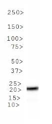 MGMT Antibody (clone MT 23.2)