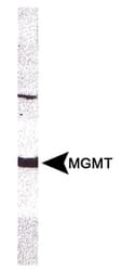 MGMT Antibody (clone MT 23.2)