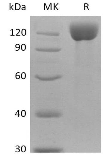 Human ANPEP / CD13 Protein (Recombinant 6His, C-terminus)
