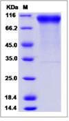 Human ERBB2 / HER2 Protein (Recombinant His,C-terminus)