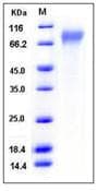 Human CD30 Protein (Recombinant His,C-terminus)