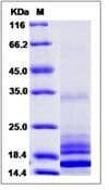 Human IL17 Protein (Recombinant)