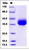 Zebrafish efnb2a Protein (Recombinant His,C-terminus)