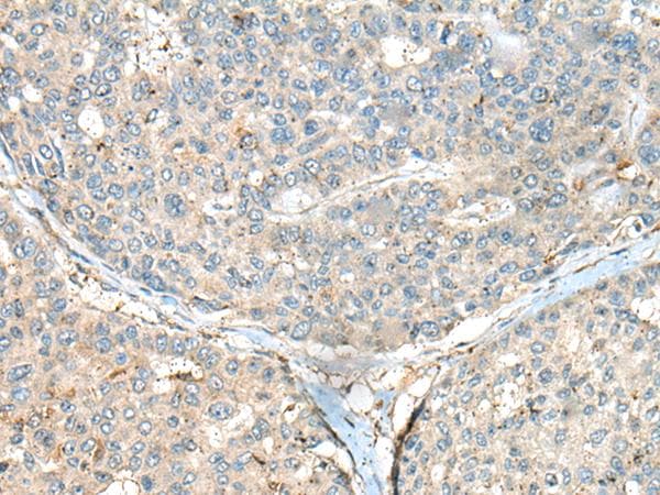 Polyclonal Rabbit anti-Human CASR/Calcium Sensing Receptor Antibody (IHC)