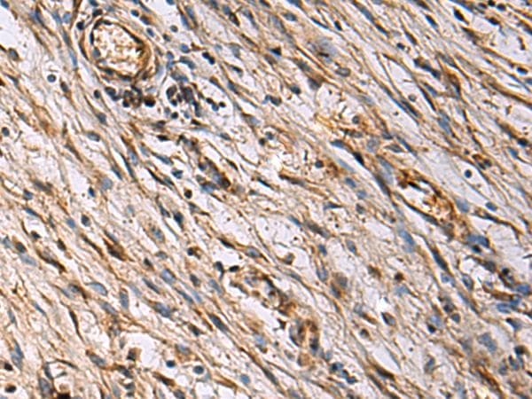 Polyclonal Rabbit anti-Human ECM1 Antibody (aa134-167, IHC, WB)