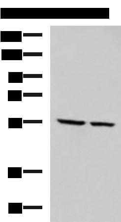 Polyclonal Rabbit anti-Human ECM1 Antibody (aa134-167, IHC, WB)