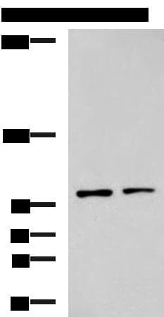 Polyclonal Rabbit anti-Human GLI / GLI1 Antibody (IHC, WB)