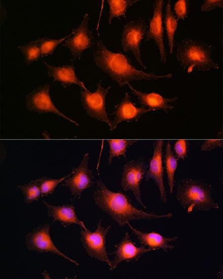 Polyclonal Rabbit anti-Human MAPT / Tau Antibody (IF)