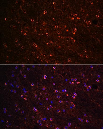 Polyclonal Rabbit anti-Human MAPT / Tau Antibody (IF)