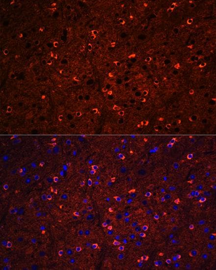 Polyclonal Rabbit anti-Human MAPT / Tau Antibody (IF)