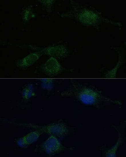 Polyclonal Rabbit anti-Human VHL / Von Hippel Lindau Antibody (IHC, IF)