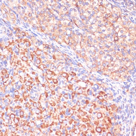 Polyclonal Rabbit anti-Human VHL / Von Hippel Lindau Antibody (IHC, IF)