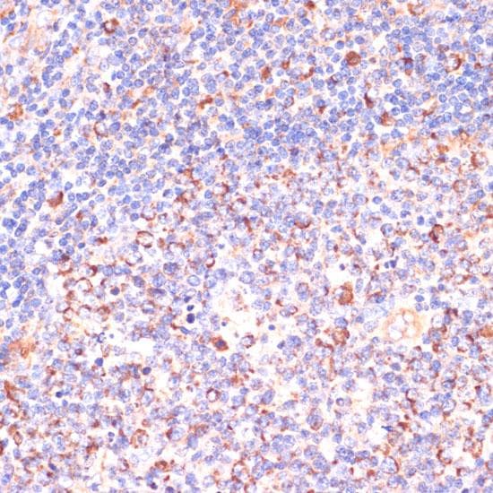 Polyclonal Rabbit anti-Human VHL / Von Hippel Lindau Antibody (IHC, IF)