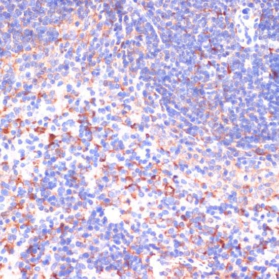 Polyclonal Rabbit anti-Human VHL / Von Hippel Lindau Antibody (IHC, IF)