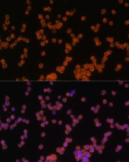 Polyclonal Rabbit anti-Human MYD88 Antibody (IF)