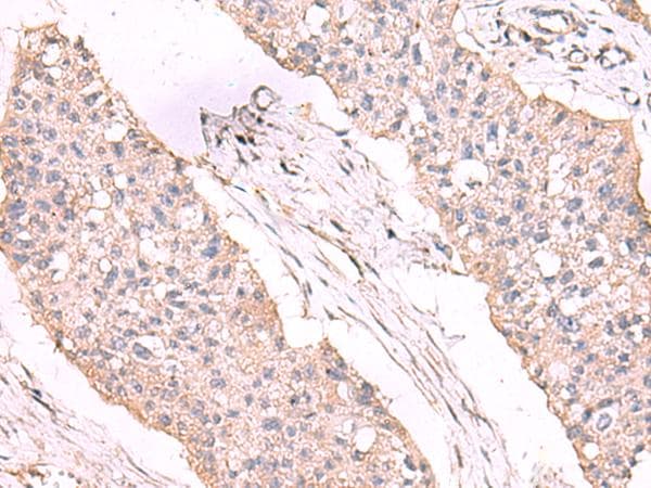 Polyclonal Rabbit anti-Human ESM1 / Endocan Antibody (IHC)