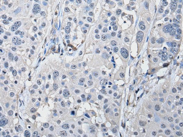 Polyclonal Rabbit anti-Human PRKAR2A Antibody (IHC, WB)
