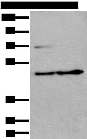 Polyclonal Rabbit anti-Human PRKAR2A Antibody (IHC, WB)