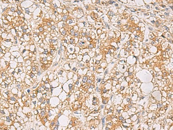 Polyclonal Rabbit anti-Human PTPRN / IA-2 Antibody (IHC)
